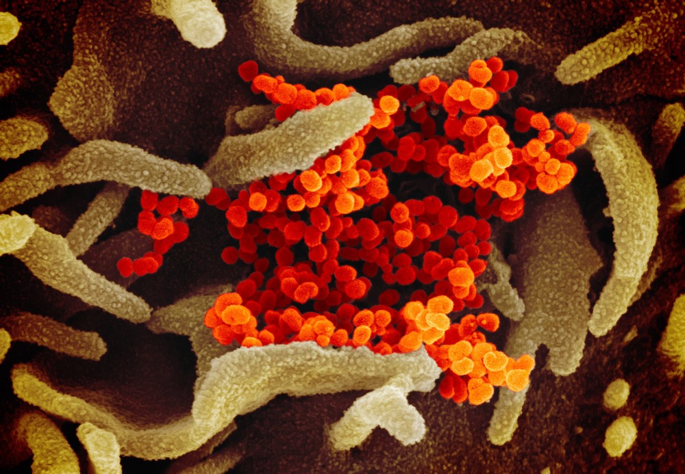 coronavirus-image-2.jpg