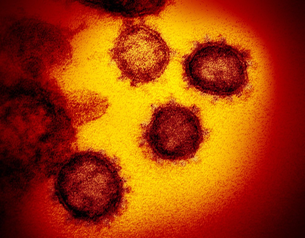 coronavirus-image-5.jpg