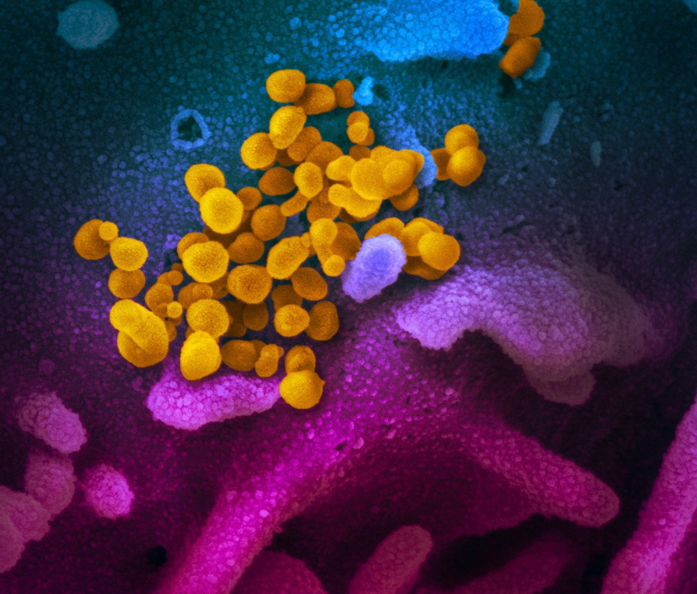 coronavirus-image-6.jpg
